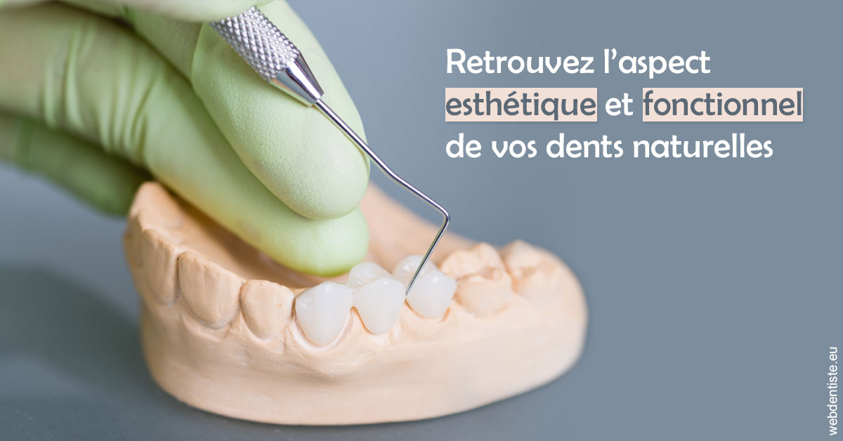 https://dr-benoit-bertini.chirurgiens-dentistes.fr/Restaurations dentaires 1