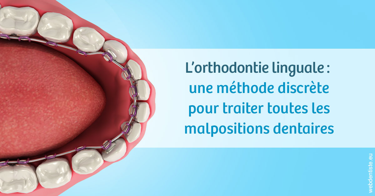 https://dr-benoit-bertini.chirurgiens-dentistes.fr/L'orthodontie linguale 1