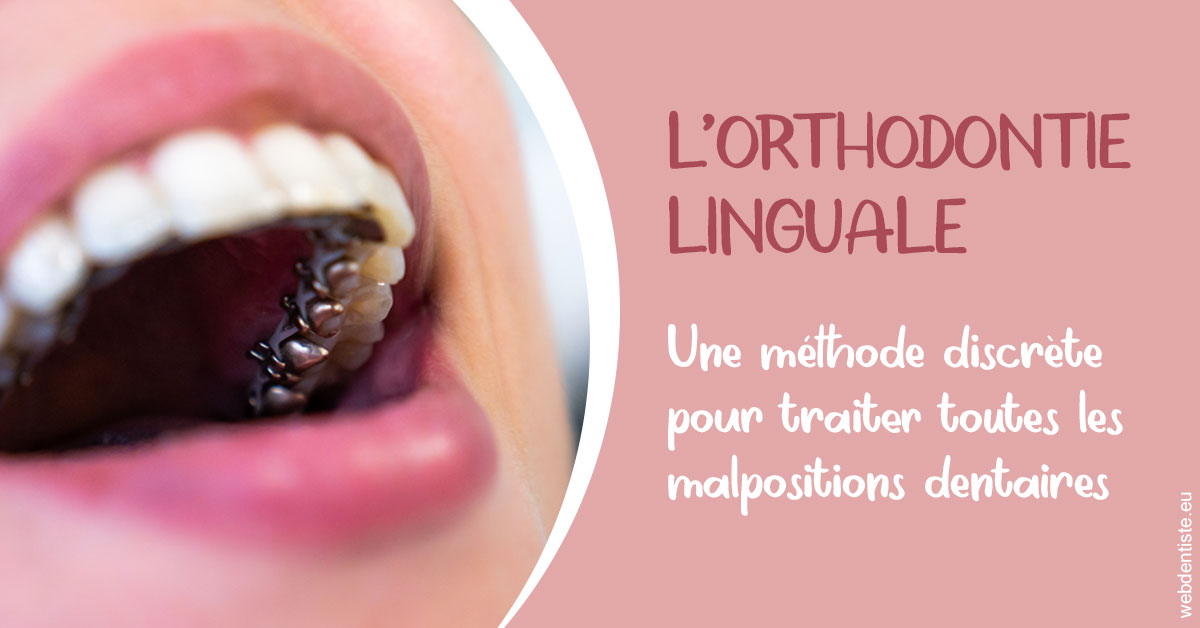 https://dr-benoit-bertini.chirurgiens-dentistes.fr/L'orthodontie linguale 2