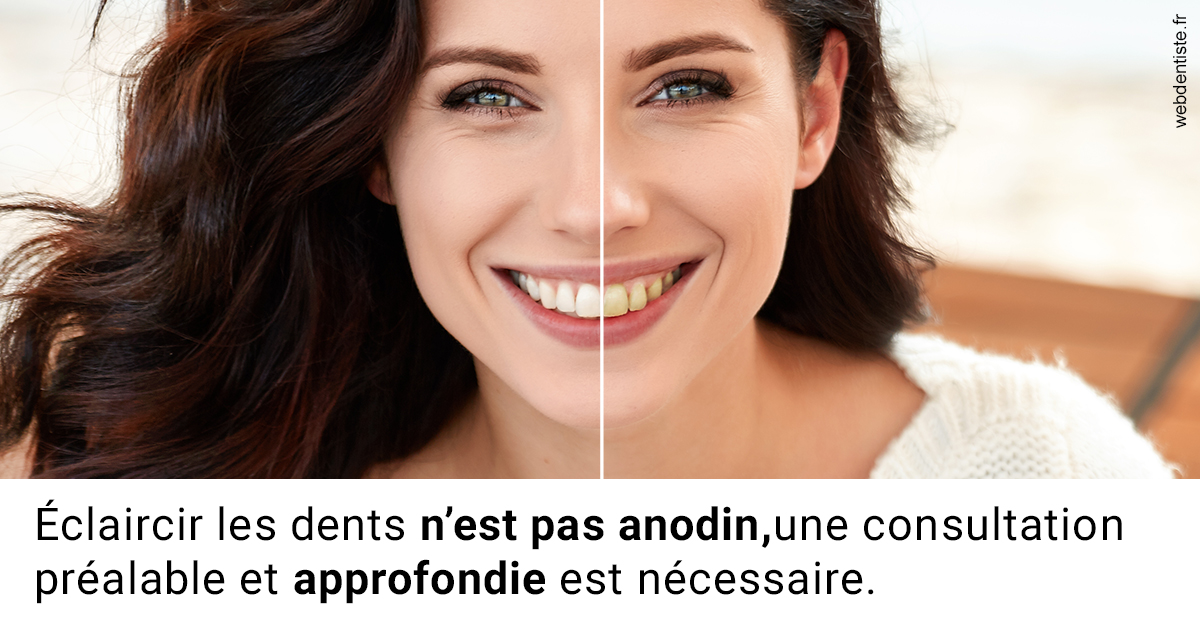 https://dr-benoit-bertini.chirurgiens-dentistes.fr/Le blanchiment 2