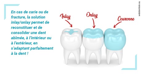 https://dr-benoit-bertini.chirurgiens-dentistes.fr/L'INLAY ou l'ONLAY