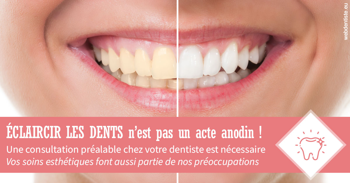 https://dr-benoit-bertini.chirurgiens-dentistes.fr/Eclaircir les dents 1