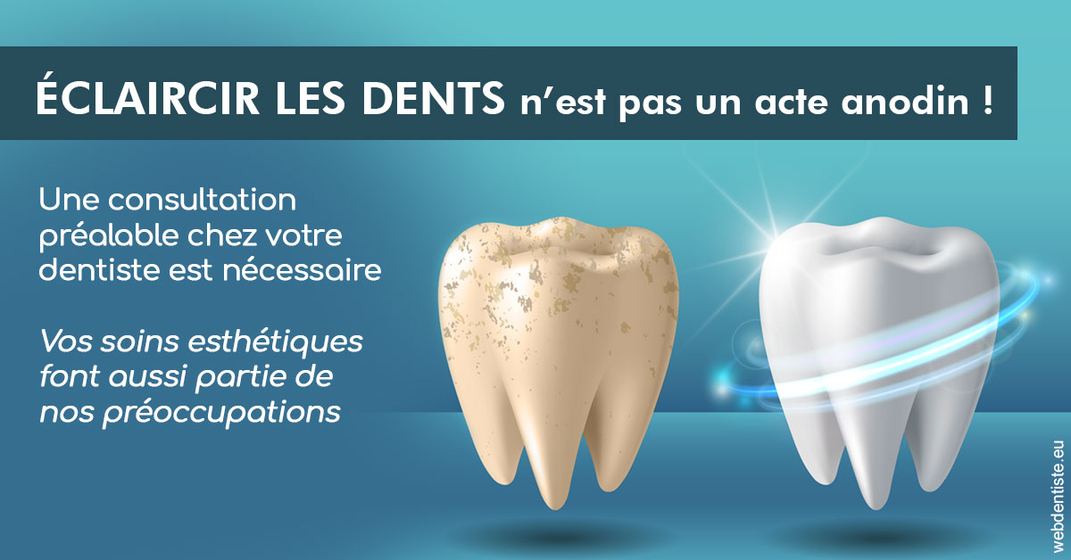 https://dr-benoit-bertini.chirurgiens-dentistes.fr/Eclaircir les dents 2
