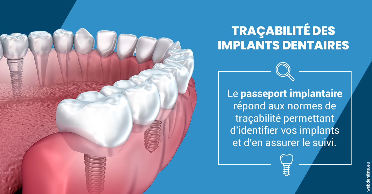 https://dr-benoit-bertini.chirurgiens-dentistes.fr/T2 2023 - Traçabilité des implants 1