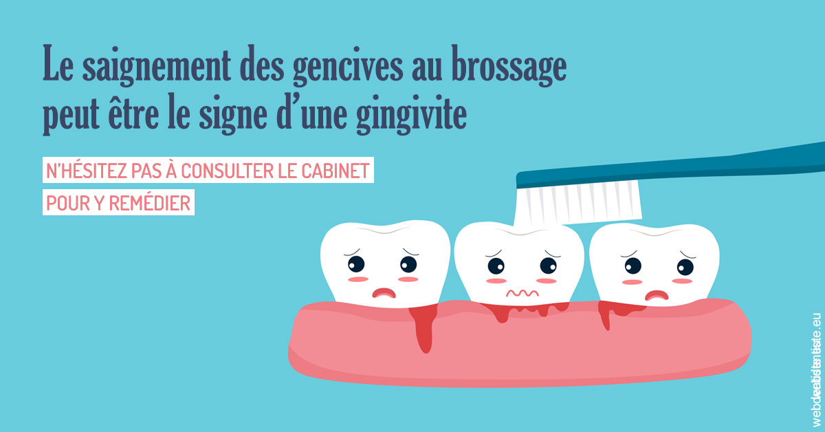 https://dr-benoit-bertini.chirurgiens-dentistes.fr/Saignement gencives 2