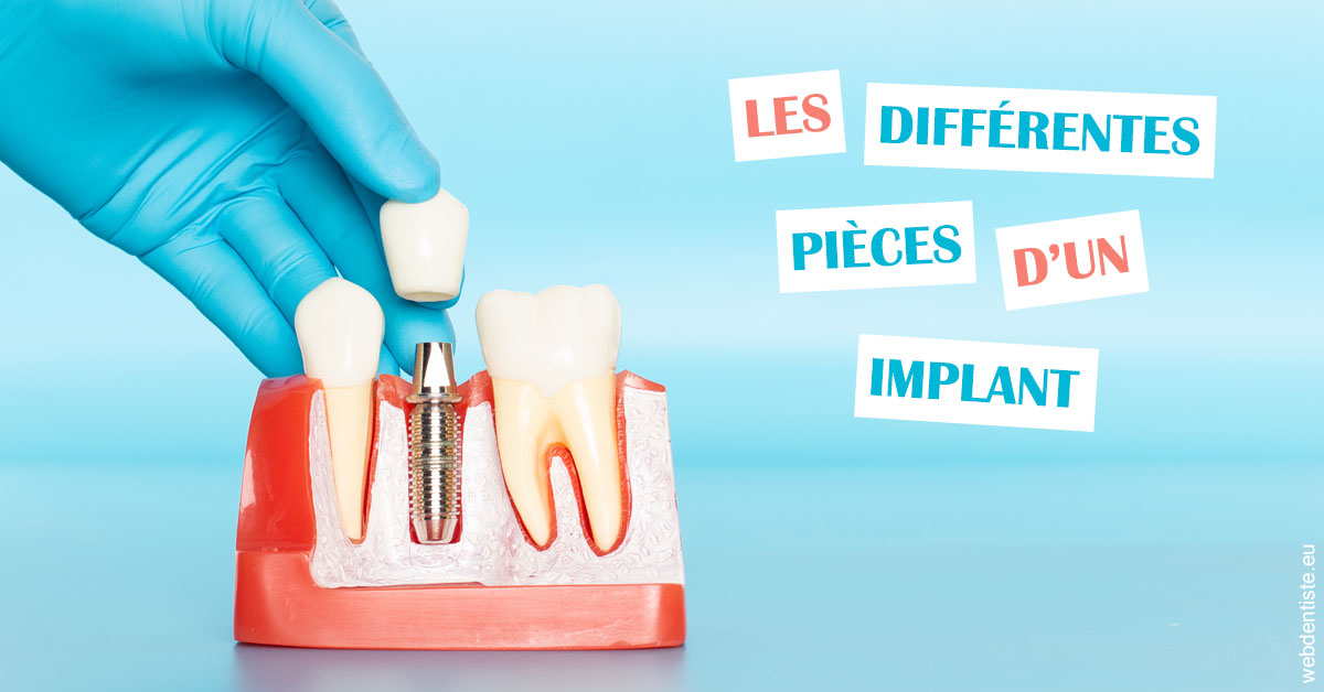 https://dr-benoit-bertini.chirurgiens-dentistes.fr/Les différentes pièces d’un implant 2