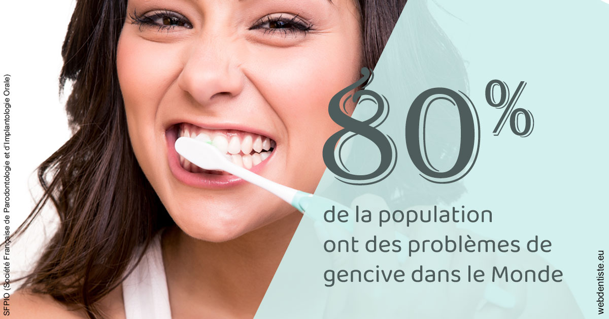 https://dr-benoit-bertini.chirurgiens-dentistes.fr/Problèmes de gencive 1