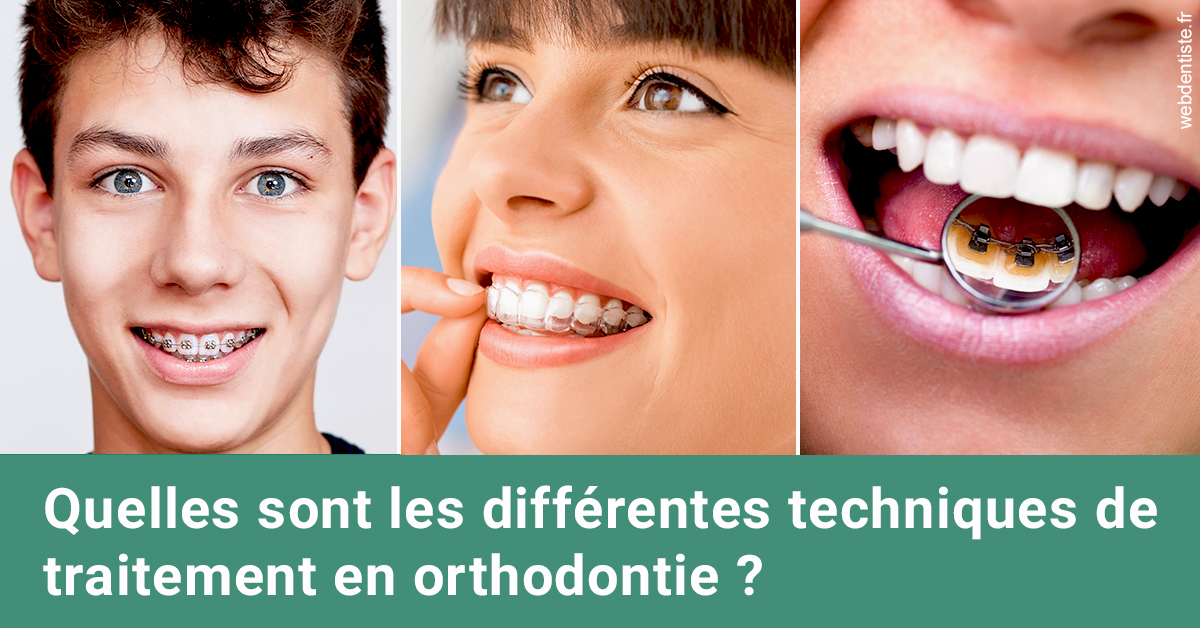 https://dr-benoit-bertini.chirurgiens-dentistes.fr/Les différentes techniques de traitement 2