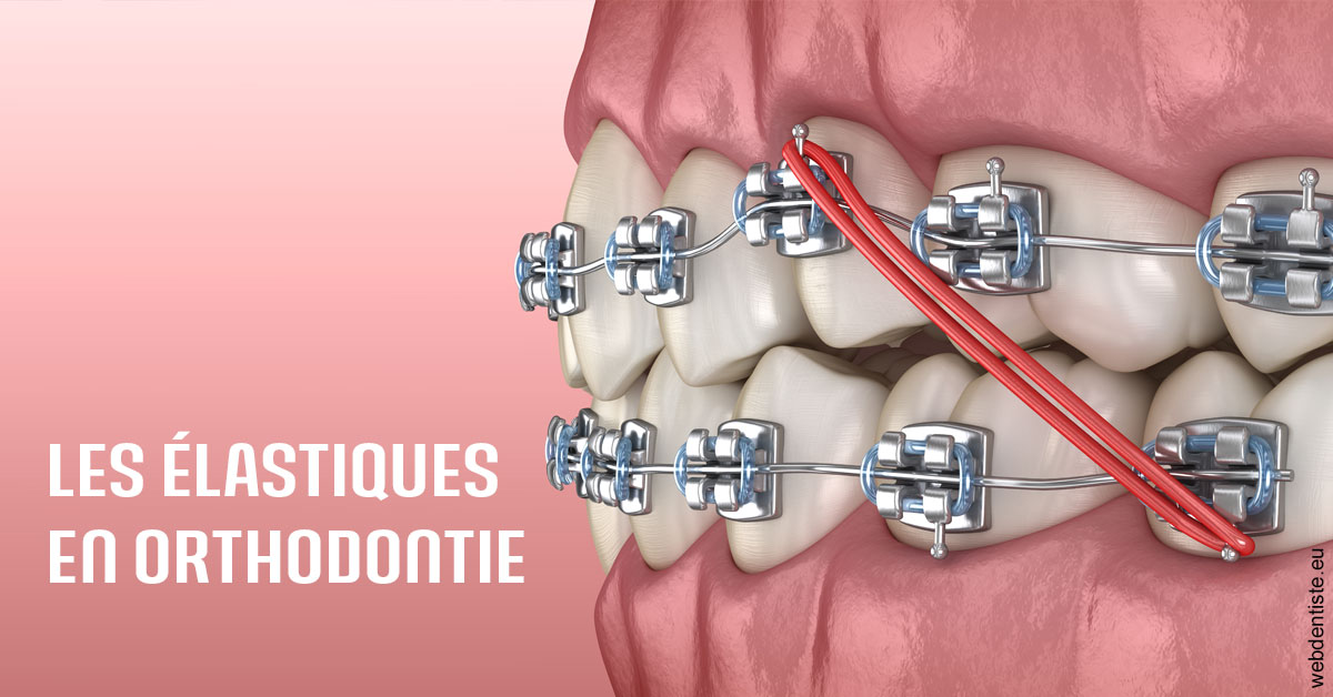 https://dr-benoit-bertini.chirurgiens-dentistes.fr/Elastiques orthodontie 2