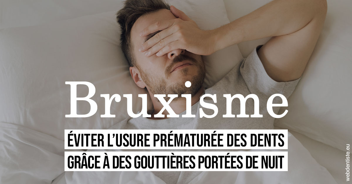https://dr-benoit-bertini.chirurgiens-dentistes.fr/Bruxisme 1